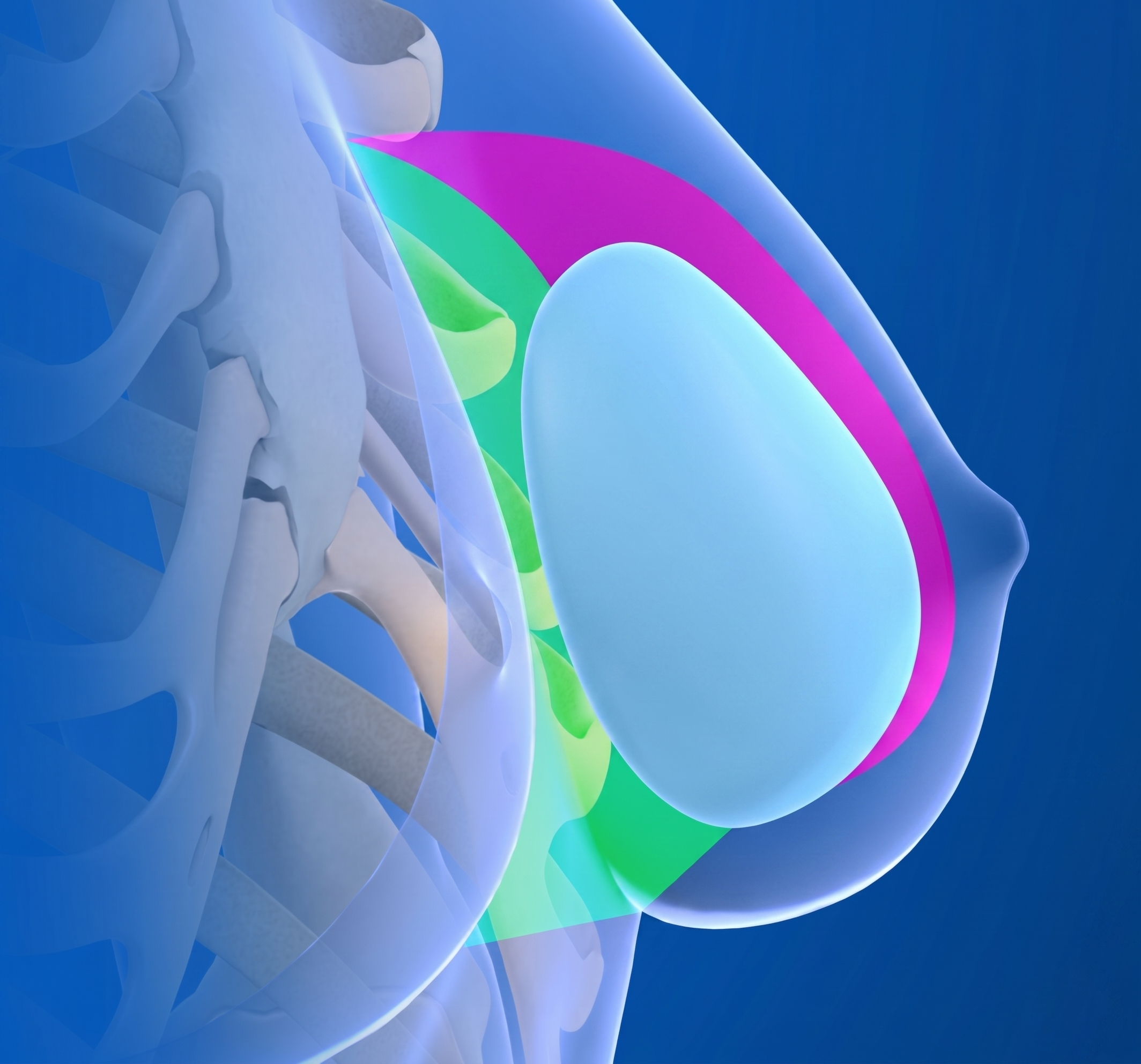 Breast Augmentation — illustration