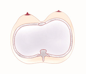 Asymmetric Chest