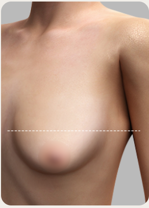 Step 2