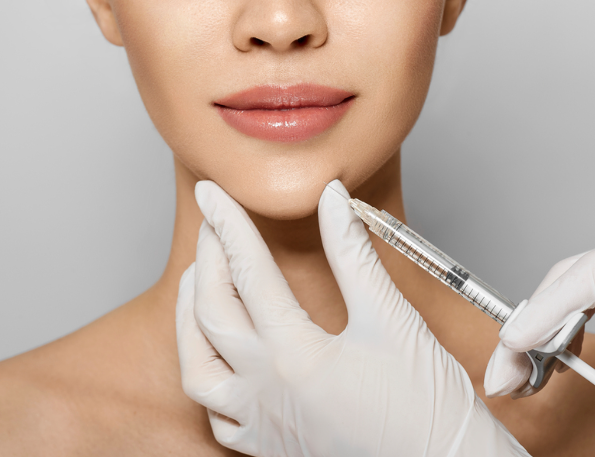 Collagen Stimulators — illustration
