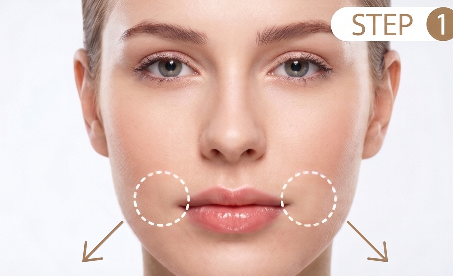 Step 1 · Incision & Muscle Balancing