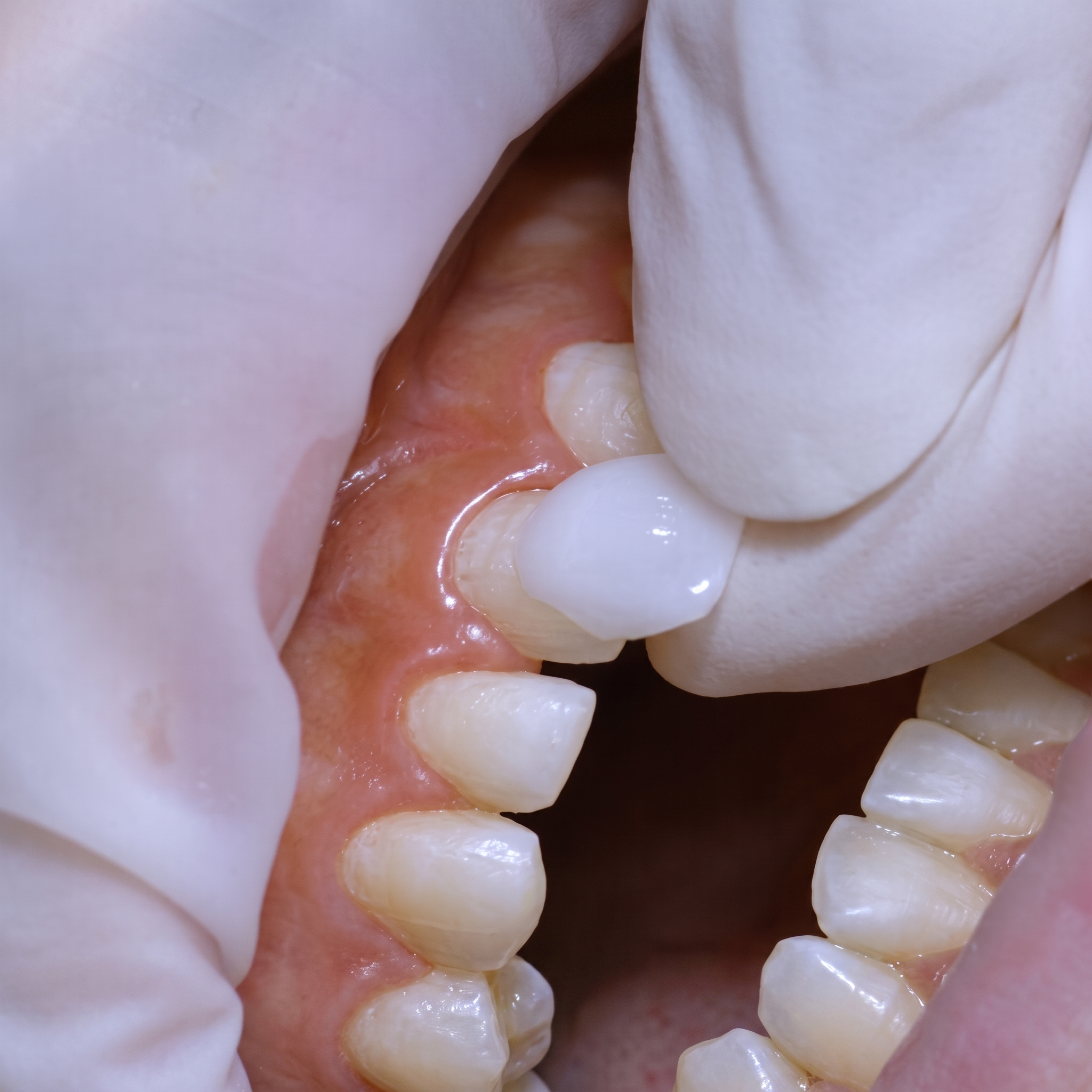 Cosmetic Dentistry — illustration