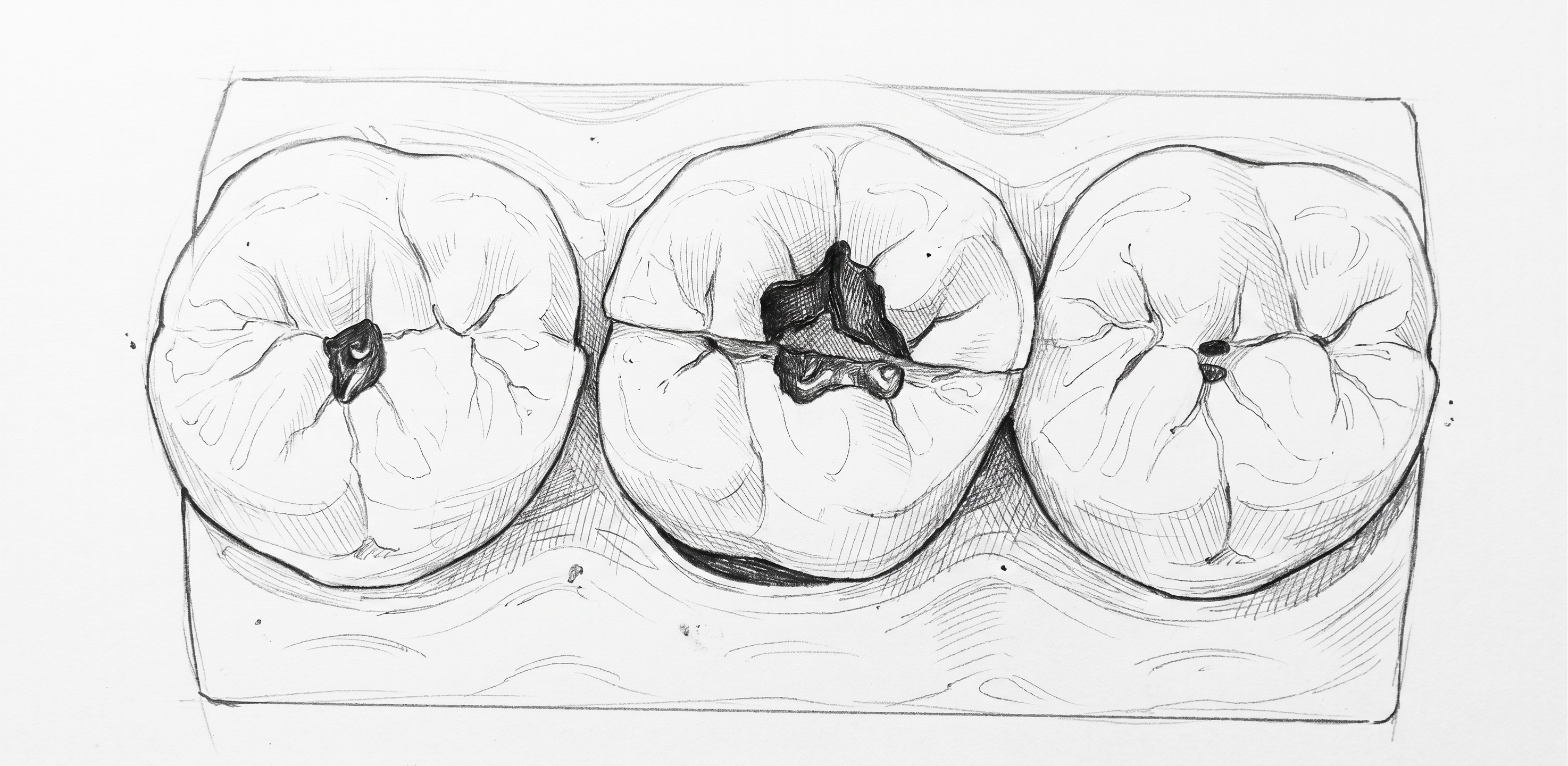 Dental