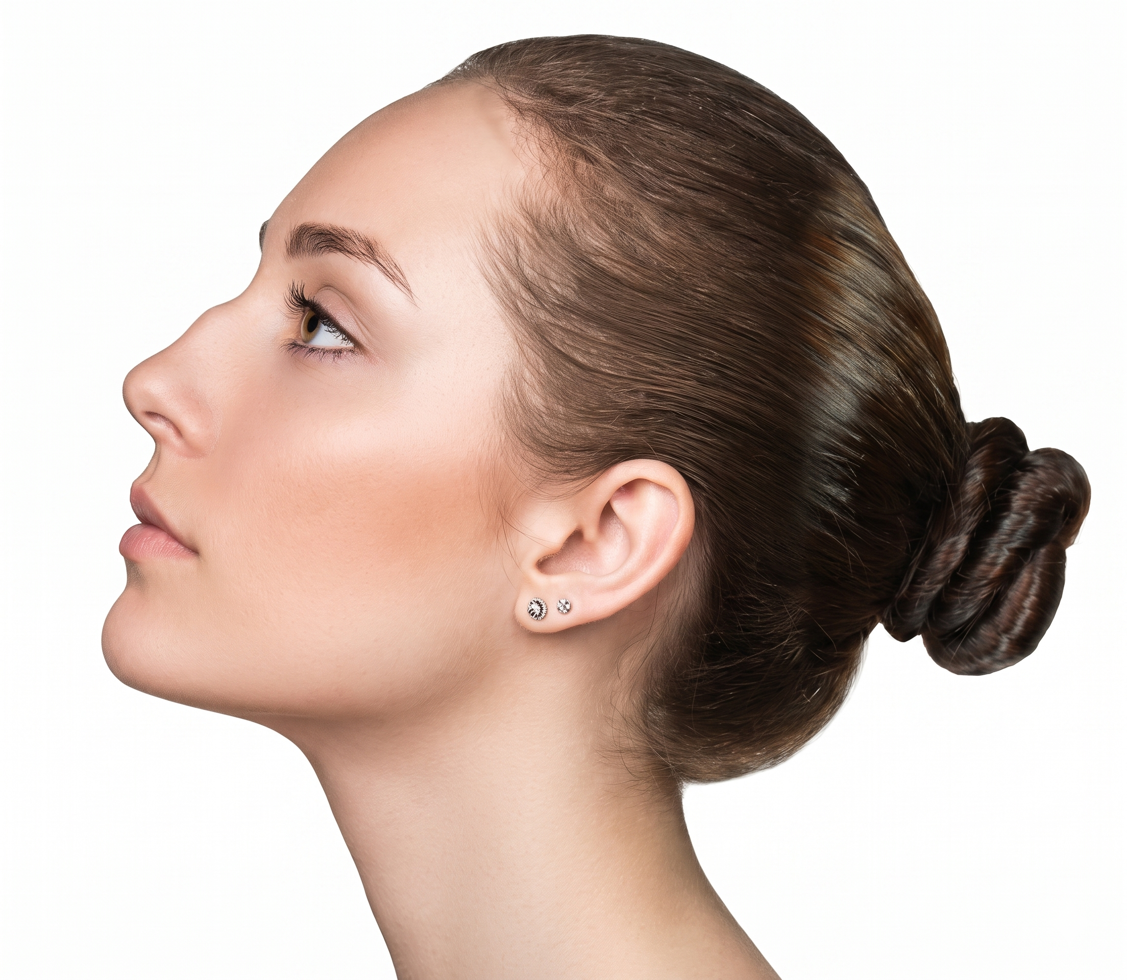 Hump Reduction — illustration