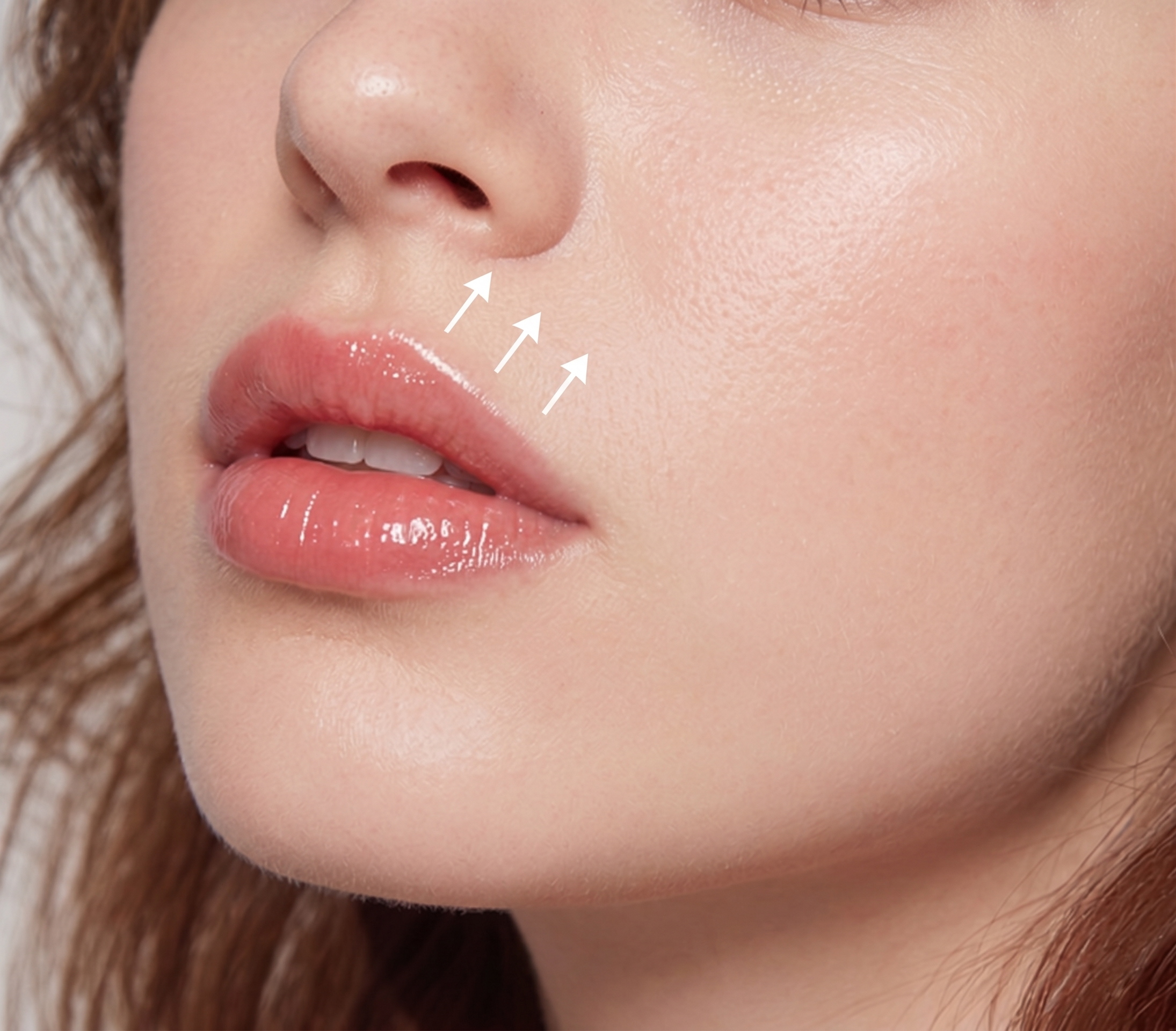 Lip Lift — illustration