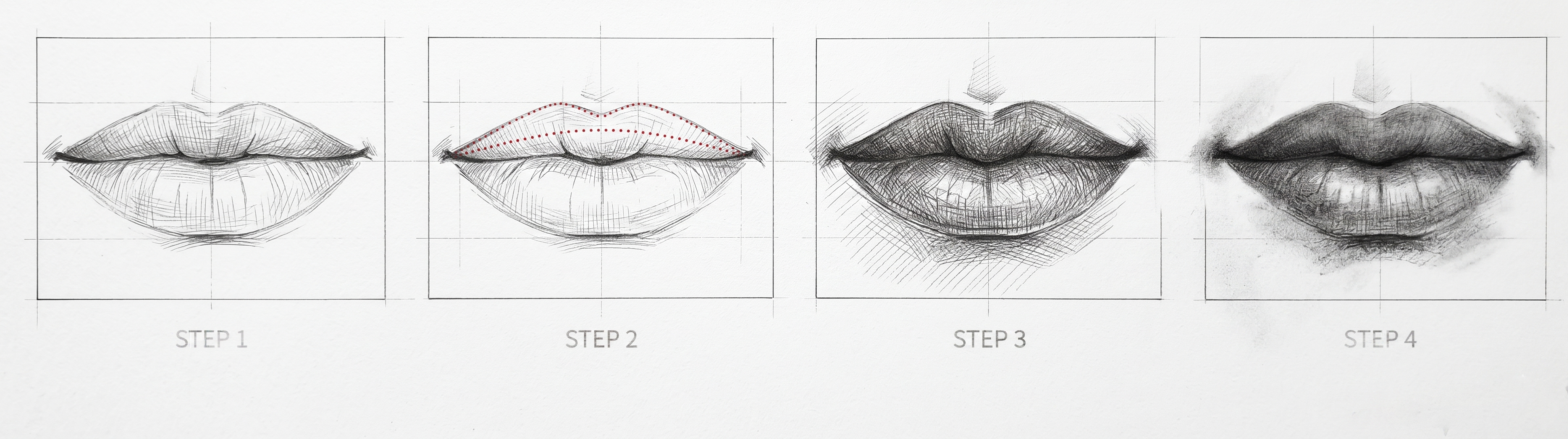 Lip Surgery