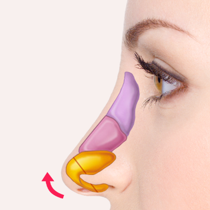 Step 2