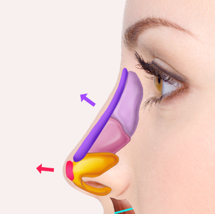Step 5