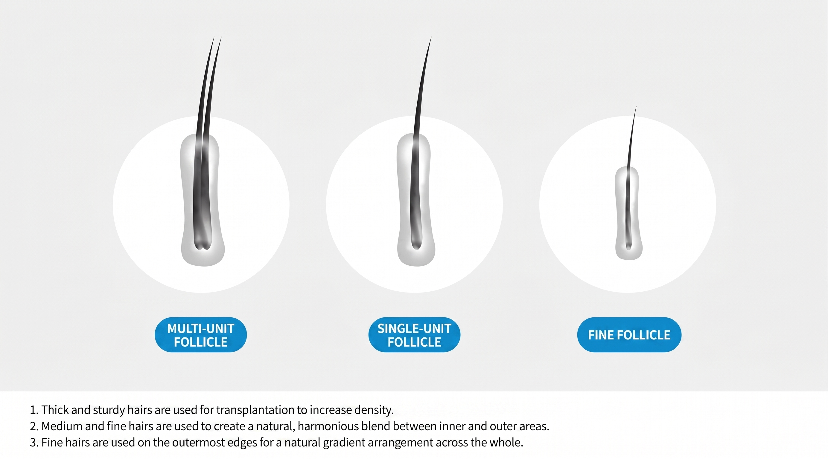 Follicle types — multi-unit follicle, single-unit follicle and fine follicle