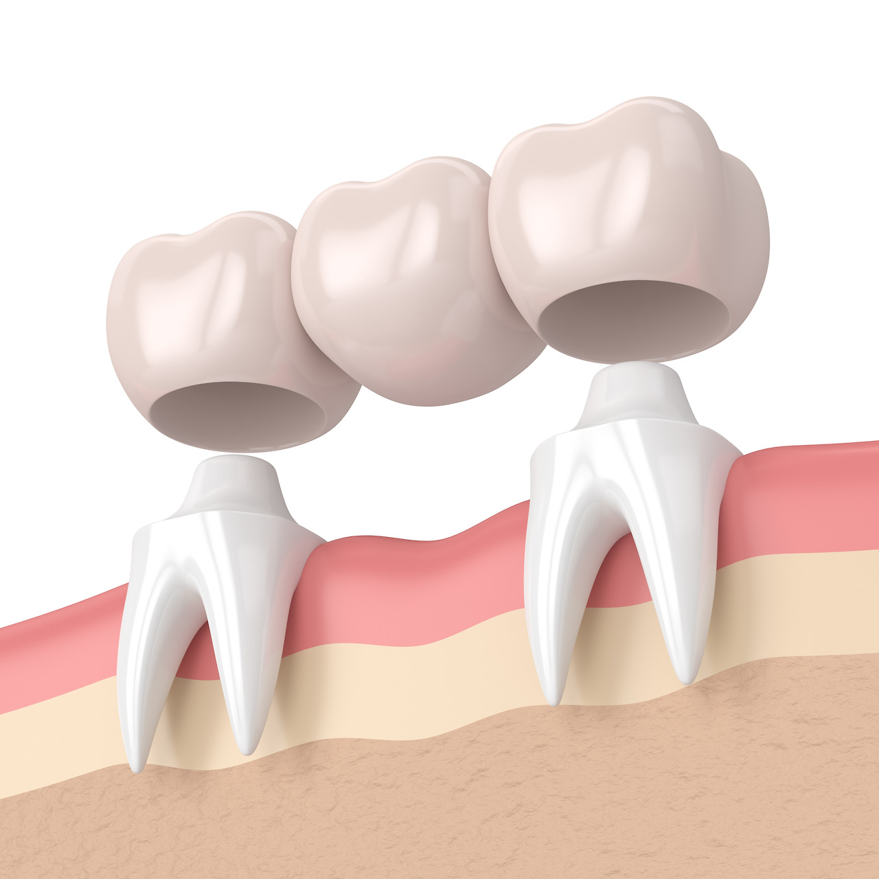 Restorative Dentistry — illustration