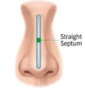 Normal Nose
