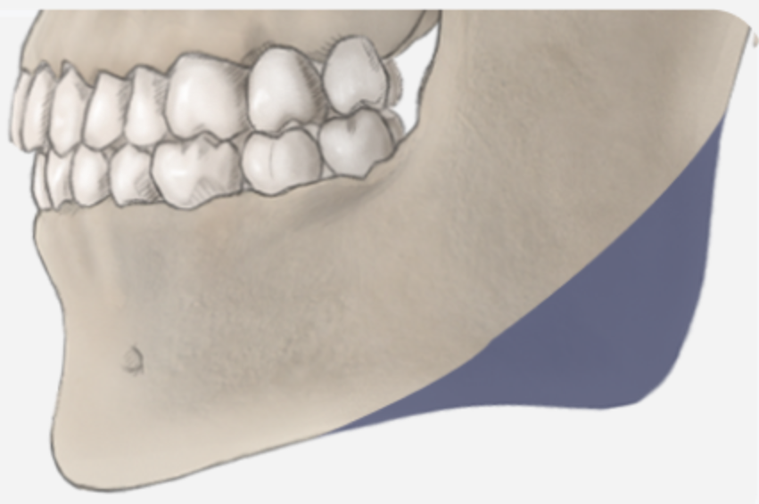 03. Mandibular Angle Reconstruction
