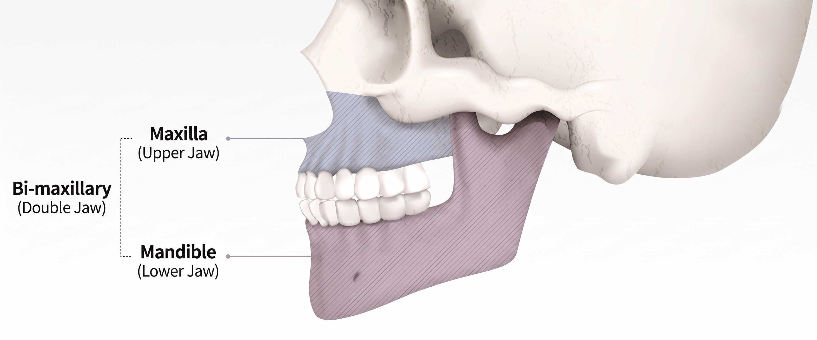 Two-Jaw Surgery anatomy