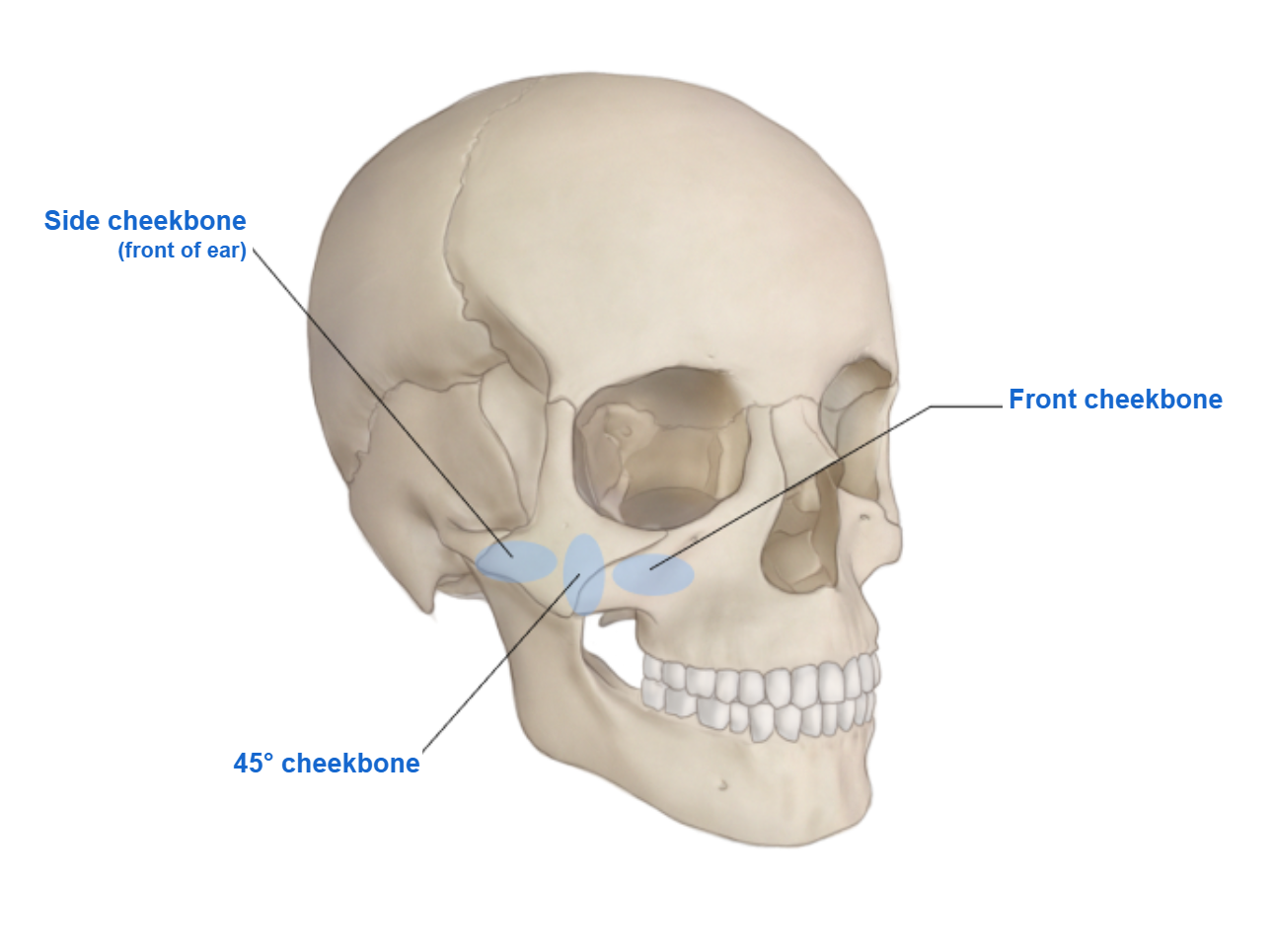 Zygoma (Cheekbone) Reduction anatomy